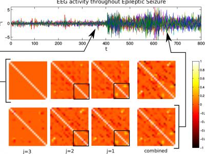 Estimated partial correlation structure throughout an epilepsy seizure